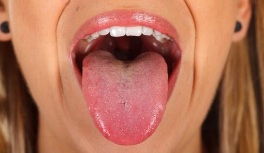 Zunge brennt? Gründe & Tipps zum Burning Mouth Syndrom!